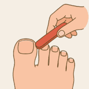 Verzorging teennagels